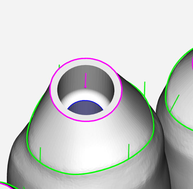 hyperDENT Webinar Series Automation