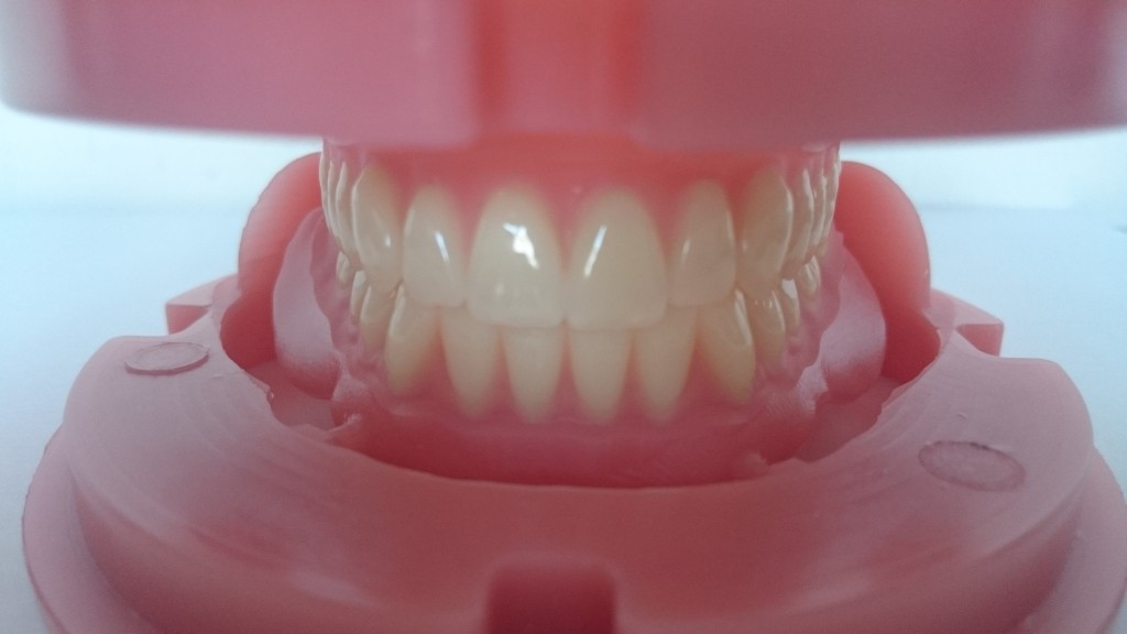 Milled full dentures