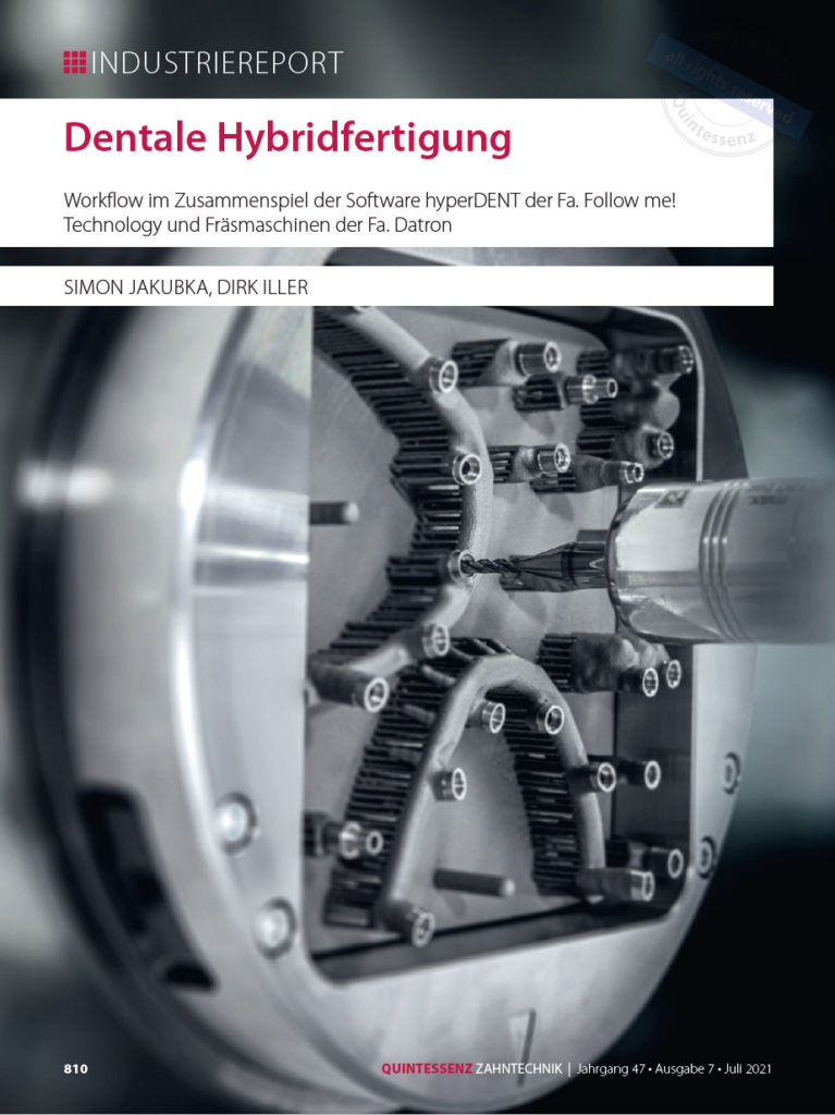 Industriereport: Dentale Hybridfertigung (Quintessenz, Juli 2021)