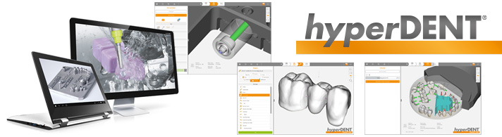 hyperDENT V9.1