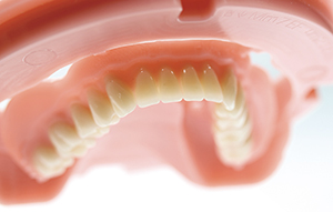 Zfx manufacturing of Baltic Dentures