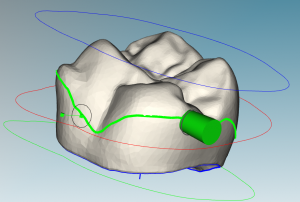 Equator line for connector placement